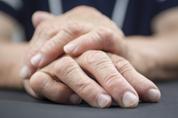 Hands Of Woman Deformed From Rheumatoid Arthritis - Photo, Image