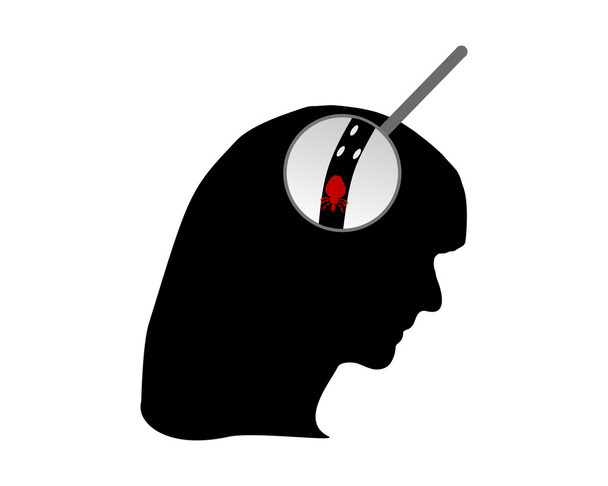 Head of woman, louse and nits - Vector, Image