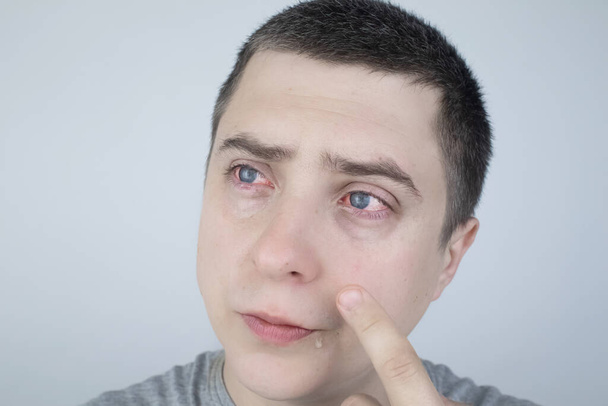 Close-up de dois olhos vermelhos irritados de sangue do sexo masculino afetados por conjuntivite ou após a gripe, frio, alergia. Espaço de cópia para propaganda. Olhos cansados depois de trabalhar no computador. Close-up de vídeos e macro - Foto, Imagem