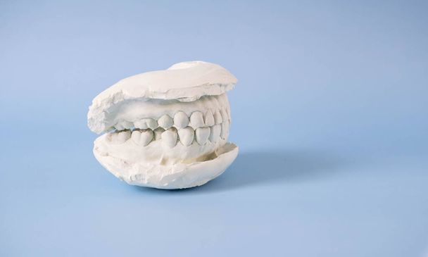 Zbliż tynk ludzki model zębów i model tynku umieszczony na niebieskim tle. Badanie stomatologiczne i koncepcja leczenia stomatologicznego. Regularne zdrowie jamy ustnej jest niezbędne dla zdrowia jamy ustnej. - Zdjęcie, obraz