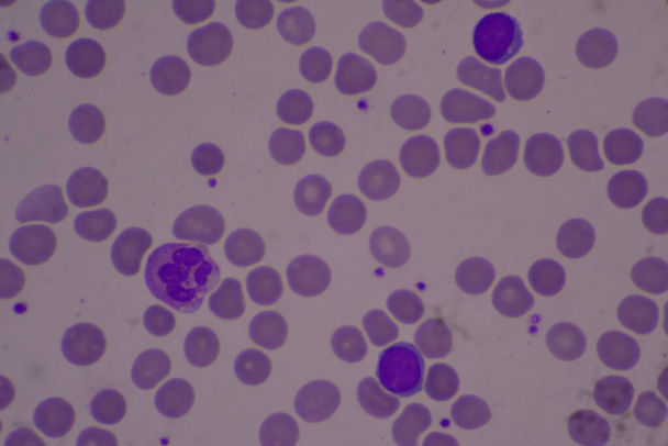 Adecuado de plaquetas en frotis de sangre compleat hemograma. - Foto, imagen