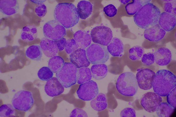 Glóbulos blancos inmaduros y maduros.Neutrofilos segmentados, mielocitos de células blásticas, metamielocitos, forma de banda. - Foto, imagen
