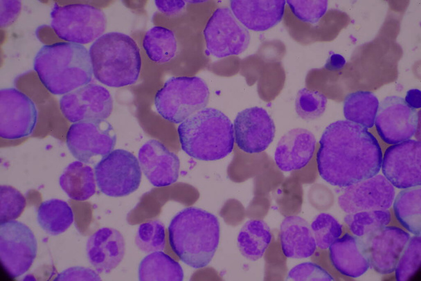 Onrijpe en rijpe witte bloedcellen.Gesegmenteerde neutrofiel, blastaire cellen myelocyt, metamyelocyt, Bandvorm. - Foto, afbeelding