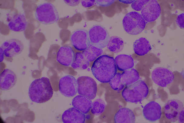 Glóbulos blancos inmaduros y maduros.Neutrofilos segmentados, mielocitos de células blásticas, metamielocitos, forma de banda. - Foto, imagen