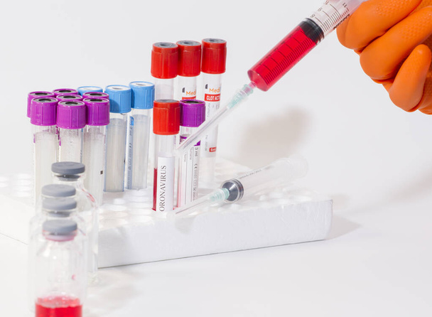 tube sanguin en laboratoire pour la détection du coronavirus  - Photo, image