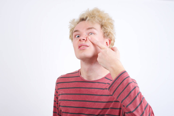 nuori vaalea mies, joka osoittaa tyytymättömästi finnistä otsaan, ruma mustan pään tulehdus. Akne ja iho-ongelma - Valokuva, kuva