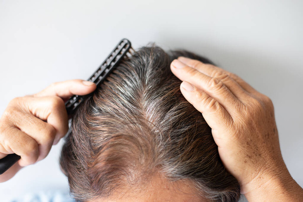 Крупный план Волосы растут на голове старухи - Фото, изображение
