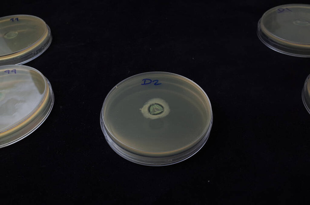 Bakterienwachstum in der Agar-Platte, um die Haftungsfähigkeit rund um die Kontaktlinse zu testen - Foto, Bild