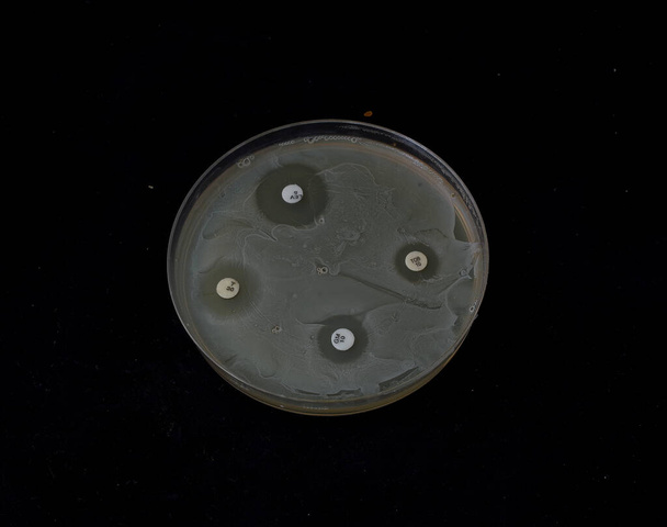 bakteerien kasvu agarilla antibioottilevyillä bakteerien herkkyyden testaamiseksi - Valokuva, kuva