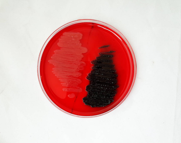 bakteryjna fartuch na czerwonej płycie agaru Konga do badania zdolności bakterii do broduce biofilm - Zdjęcie, obraz
