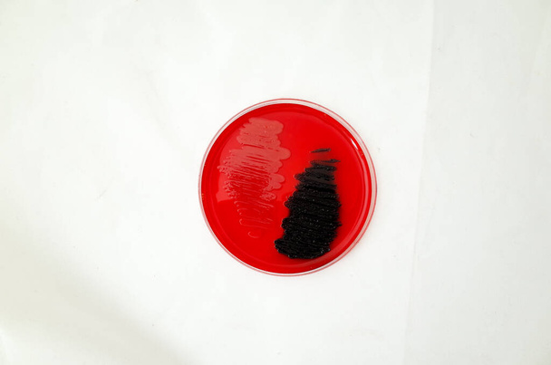 crecimiento bacteriano en la placa de agar rojo Congo para probar la capacidad de las bacterias para brotar biopelícula - Foto, imagen