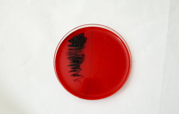 bakteryjna fartuch na czerwonej płycie agaru Konga do badania zdolności bakterii do broduce biofilm - Zdjęcie, obraz