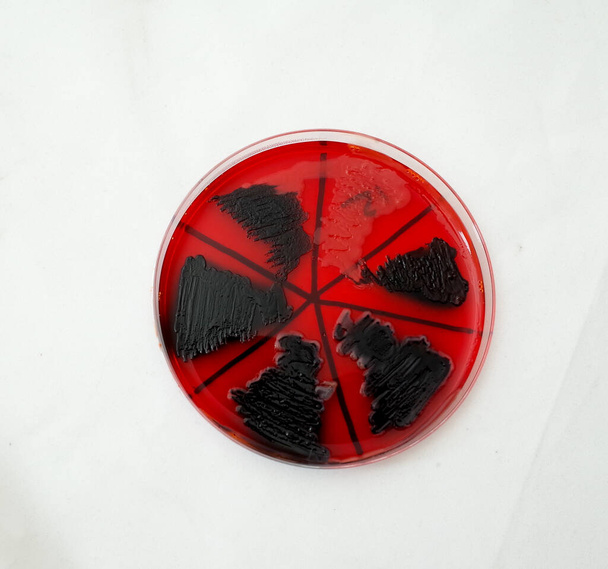 Bakterilerin biyofilm üretme yeteneğini test etmek için Kongo kırmızı agar plakası üzerinde bakteriyel gowth - Fotoğraf, Görsel