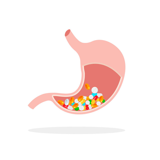 Unhealthy full medicines human stomach in trendy flat style. Pills in internal organ. Nutrition, stomach pain, bloating. Digestive system anatomy. Vector illustration isolated on white background. - Wektor, obraz