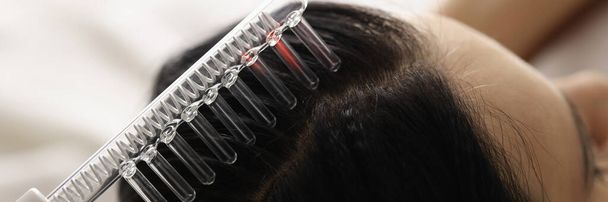 Sur les cheveux féminins, il existe un dispositif pour la restauration des follicules pileux - Photo, image