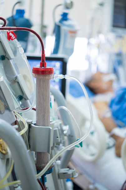 Odborníci připravují dialyzační stroj pro použití u kriticky nemocných pacientů na nemocničních jednotkách intenzivní péče. - Fotografie, Obrázek