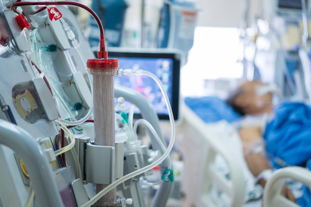 Especialistas estão preparando uma máquina de diálise para uso em pacientes críticos em unidades de terapia intensiva hospitalar. - Foto, Imagem