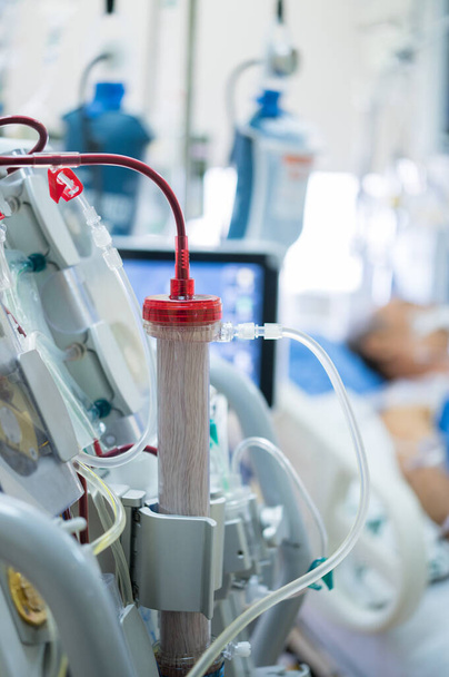 Expertos están preparando una máquina de diálisis para uso en pacientes críticos en unidades de cuidados intensivos hospitalarios. - Foto, imagen