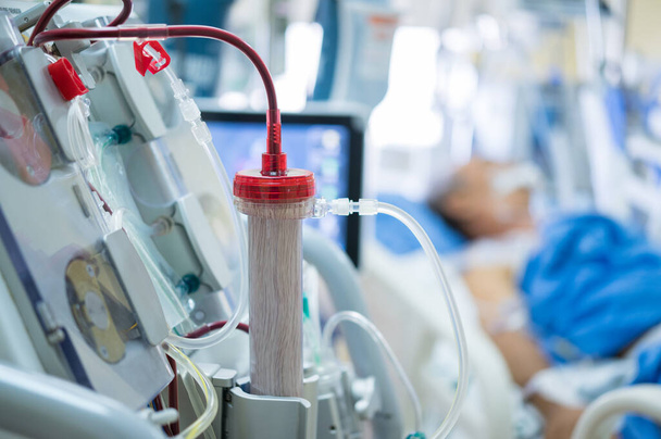 Deskundigen bereiden een dialyseapparaat voor voor gebruik bij ernstig zieke patiënten op intensive care-afdelingen van het ziekenhuis.. - Foto, afbeelding