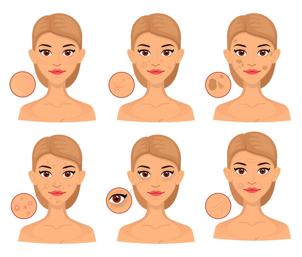 Сект-жінка різні типи проблемної шкіри, збільшена площа для косметології. Акна, зморшки і вікові плями.. - Вектор, зображення