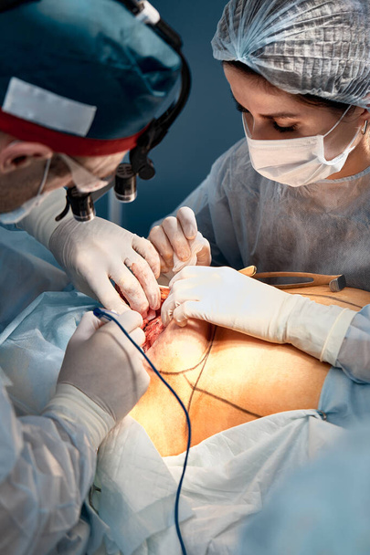 Zespół chirurgów męskich i żeńskich operuje raka piersi, mammoplastykę z rekonstrukcją plastyczną, zbliżenie, nowoczesne metody walki z onkologią - Zdjęcie, obraz