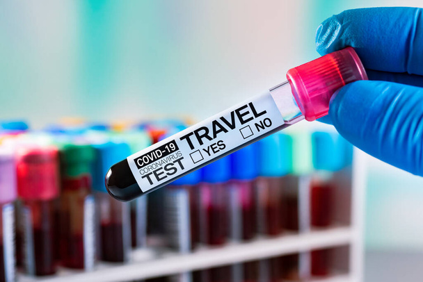 血液チューブは、名前Covid-19コロナウイルステスト、旅行はいまたはいラベルされています。旅行のために彼を検証するcovid-19抗体検査のための患者の血清学的血液分析 - 写真・画像