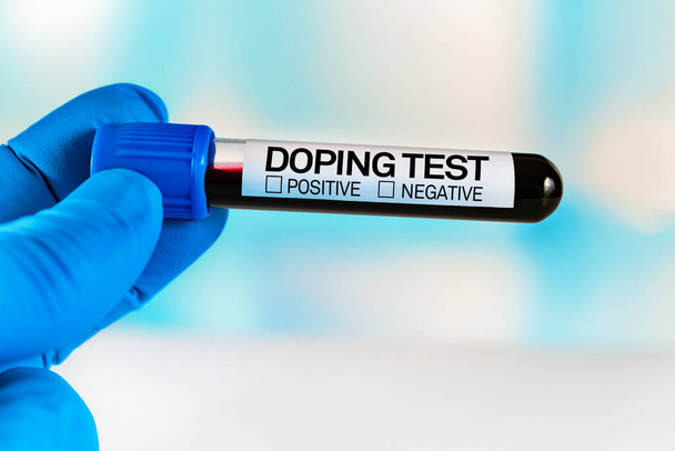 Tube of blood for analysis labeled Doping Test. Lab technician holding a blood sample tube for analysis doping substances in the laboratory - Photo, image