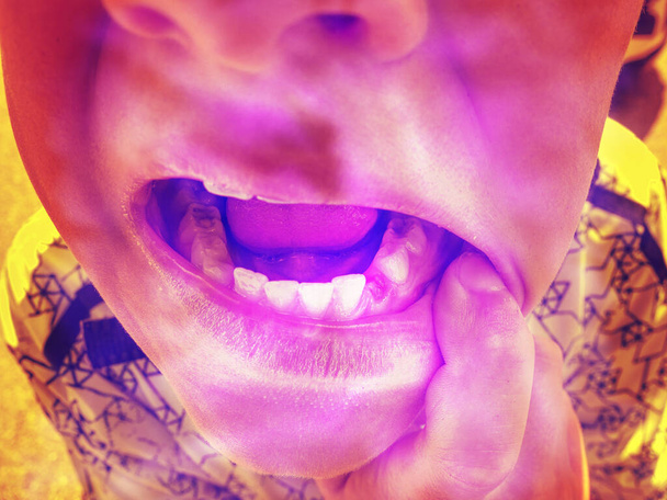 O rapaz mostra um dente desaparecido. Cores de néon efeito do rosto do menino, problema dentário. Abstrato. - Foto, Imagem