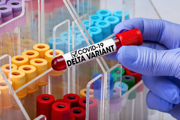 Doctor testing with blood test tube from patient infected with Coronavirus covid-19 virus Delta variant. Doctor epidemiologist holding blood tube for test detection of virus Covid-19 Delta Variant with positive result  - Photo, Image