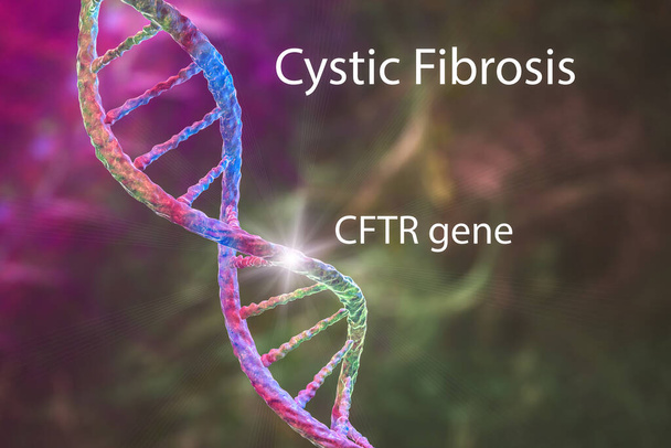 Cystische fibrose, een genetische aandoening veroorzaakt door mutatie in het CFTR gen, geërfd op een autosomale recessieve manier, die invloed heeft op longen, alvleesklier en andere organen, conceptuele 3D illustratie - Foto, afbeelding