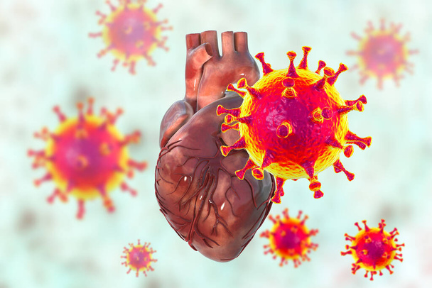 Virus COVID-19 que afectan al corazón, ilustración conceptual 3D. Complicaciones cardíacas asociadas a la enfermedad coronavirus COVID-19. El efecto negativo del virus SARS-CoV-2 en el corazón humano. - Foto, Imagen