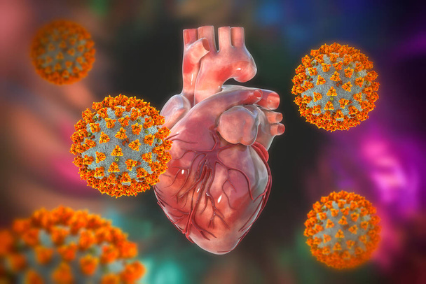 COVID-19 virussen die het hart aantasten, conceptuele 3D illustratie. Hartcomplicaties geassocieerd met COVID-19 coronavirus ziekte. Het negatieve effect van het SARS-CoV-2 virus op het menselijk hart. - Foto, afbeelding