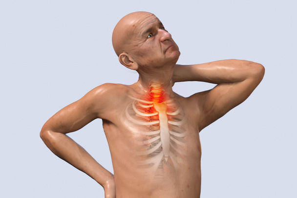 Spine pain, neck pain. X-ray of the human skeleton. Anatomy of male body. 3d medical illustration. A senior man with painful back and highlighted skeleton. Front view - Photo, Image