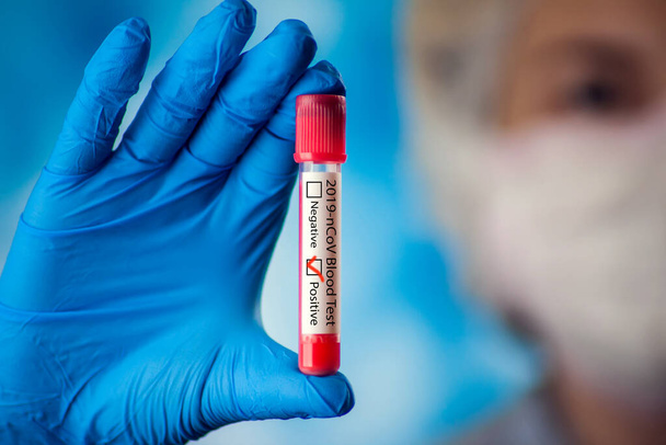 Médica em máscara médica e luvas azuis segurando tubo de teste com sangue. Conceito de coronavírus, epidemia e cuidados de saúde - Foto, Imagem