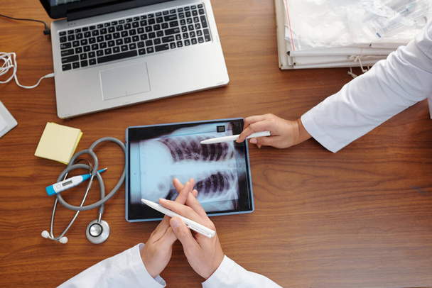 Руки врачей обсуждают рентген легких пациента с коронавирусом на совещании, вид сверху - Фото, изображение