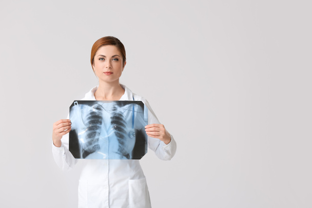 Γυναίκα γιατρός με ακτινογραφία των πνευμόνων σε γκρι φόντο - Φωτογραφία, εικόνα