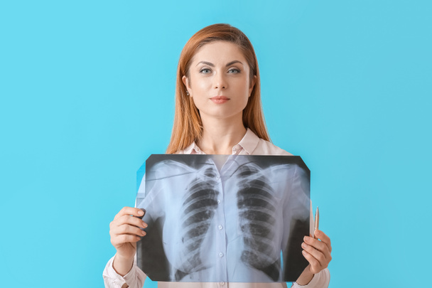Γυναίκα με ακτινογραφία εικόνας των πνευμόνων στο φόντο χρώμα - Φωτογραφία, εικόνα