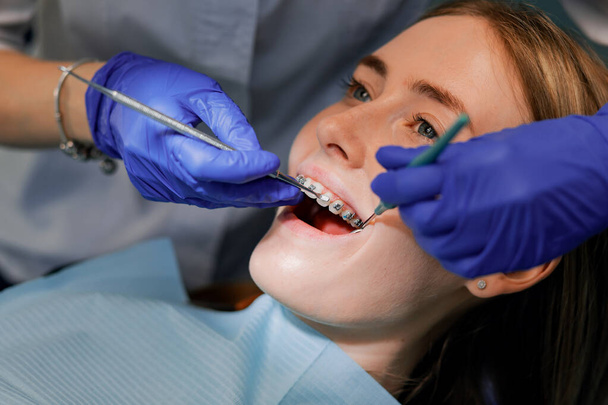 The dentist puts braces on the patient. Close-up - Foto, Imagen