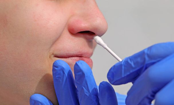 blue latex gloves of doctor performing nasal swab test for Coronavirus virus to young girl - Photo, Image
