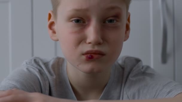 家庭内暴力や子供の虐待。顔の上に傷が頭を回すと動揺泣き小さな男の子 - 映像、動画