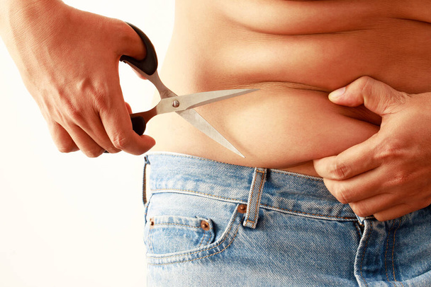 Obese mannen hebben overtollig vet - Foto, afbeelding