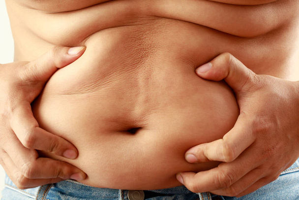 Şişman adam kilo vermek ve diyetini kontrol etmek istiyor.. - Fotoğraf, Görsel