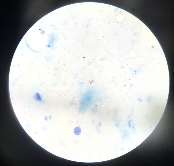 Células bacterianas na coloração de Gram. - Foto, Imagem