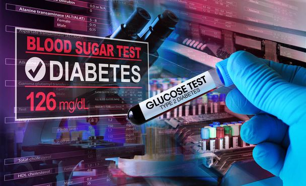 Labortechniker mit Probe für Glukosetest und Hämatologie-Analysator und Softwarescreen mit Daten des positiven Tests.  - Foto, Bild