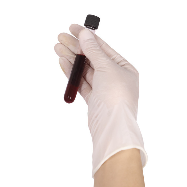 Main avec gant en latex tenant un échantillon de sang
 - Photo, image