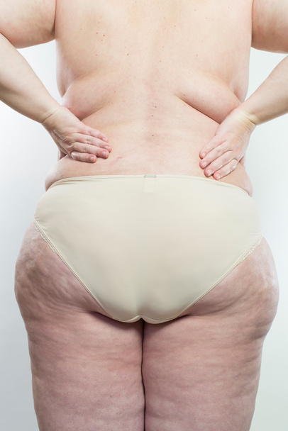 Woman showing her cellulite - Photo, image