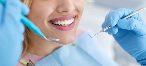 Nahaufnahme einer Patientin, die ihre schönen weißen Zähne zeigt - Foto, Bild