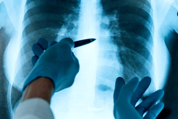 close up. medical colleagues discussing an x-ray of the lungs . - Foto, afbeelding