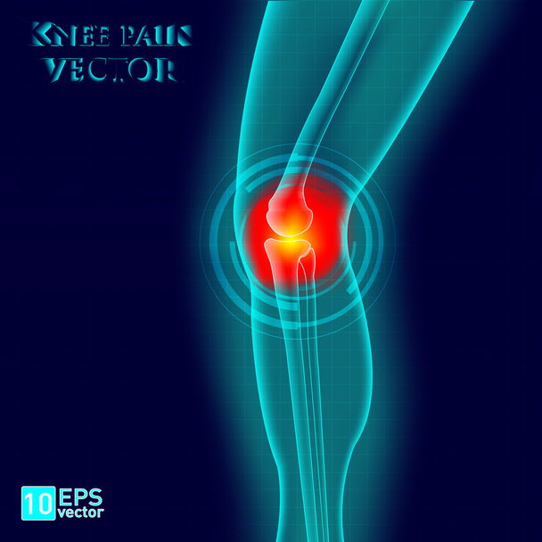 kneee ağrı - Vektör, Görsel