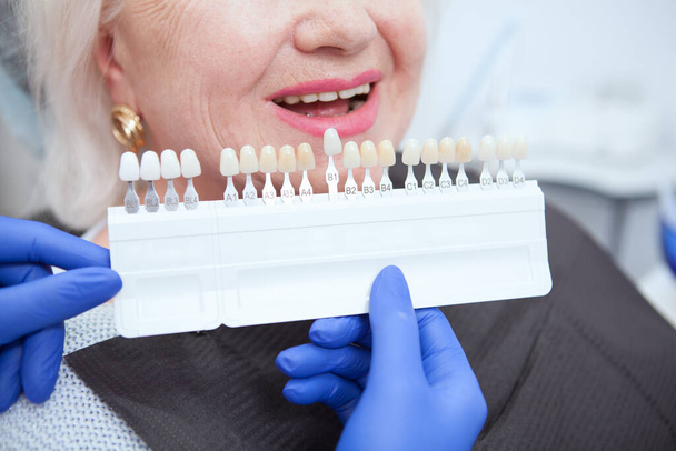 Dentista sosteniendo dientes blanqueamiento sombra guía cerca de los dientes de la paciente mayor - Foto, imagen